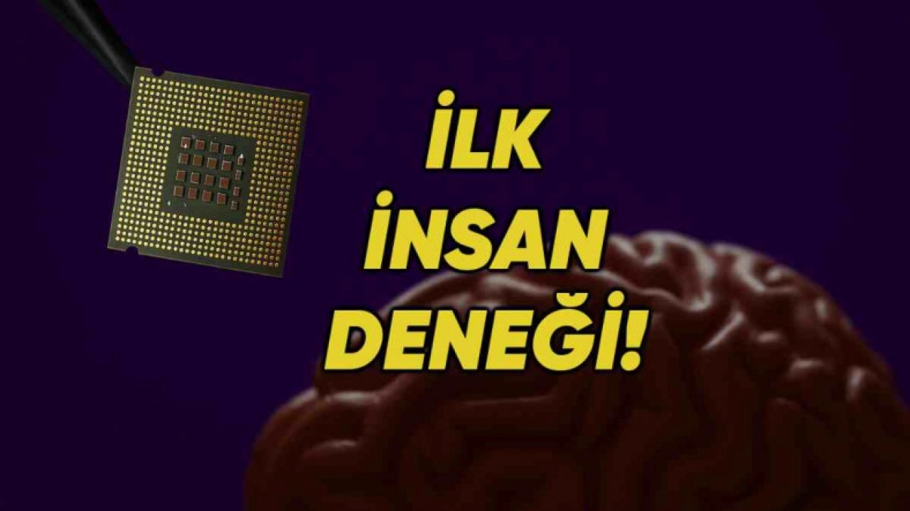 Bir Beyin İmplantı Şirketi İnsan Beynine İlk Defa Çip Yerleştirdi