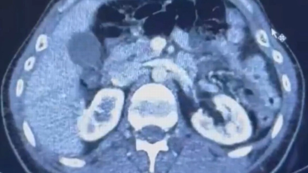 İranlı şüphelilerin midelerinde uyuşturucu tespit edildi; 3 gözaltı