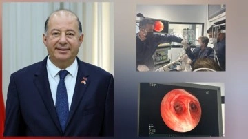 Dinçyürek: Mağusa Hastanesi Göğüs Hastalıkları Kliniği'nde eksiklikler tamamlandı