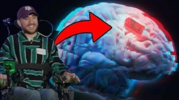 Neuralink, Beyin Çipinin İlk Başlarda Sorun Yaşadığını Duyurdu