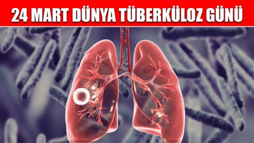Sağlık Bakanlığı'ndan Dünya Tüberküloz Günü açıklaması