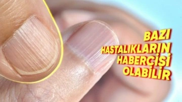 Tırnaktaki Çıkıntıların Sebebi Ne? Önleme Yöntemleri Neler?